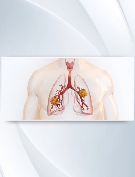 3d医疗人体结构肺部疾病