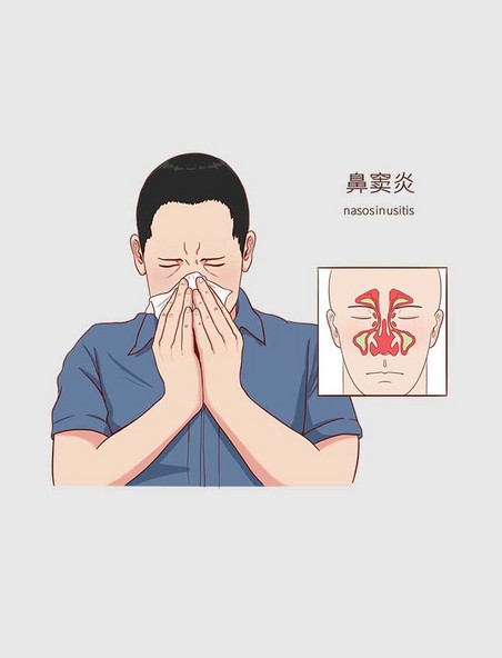 常见医疗人物疾病图例鼻窦炎