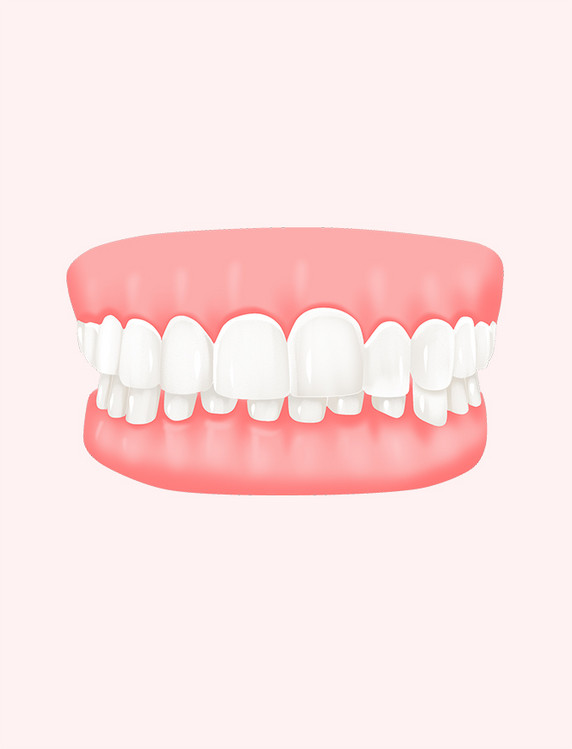 深覆合牙齿牙科整牙口腔护理美白