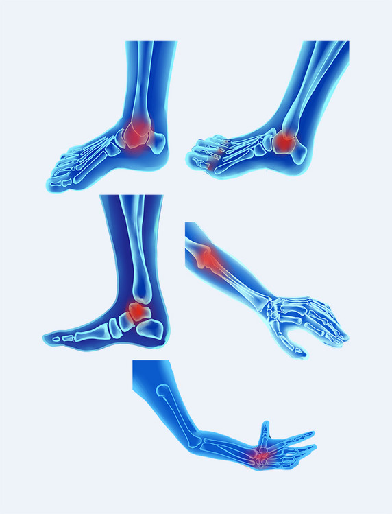 医疗科技人体骨骼脚环手腕骨骼