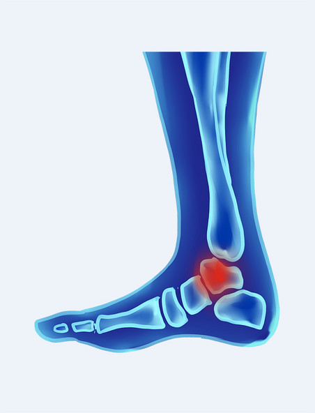 医疗科技人体骨骼脚环