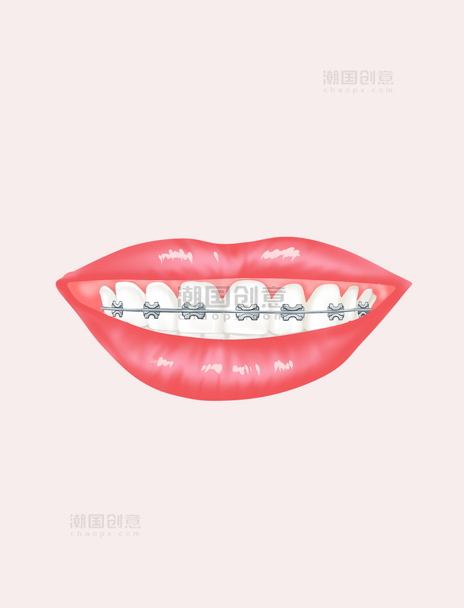牙齿美容整牙牙齿金属牙套